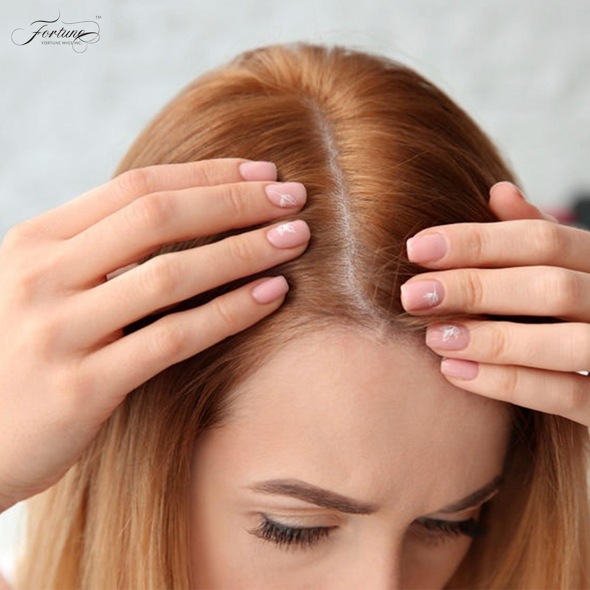 Wigs for Allopecia hair